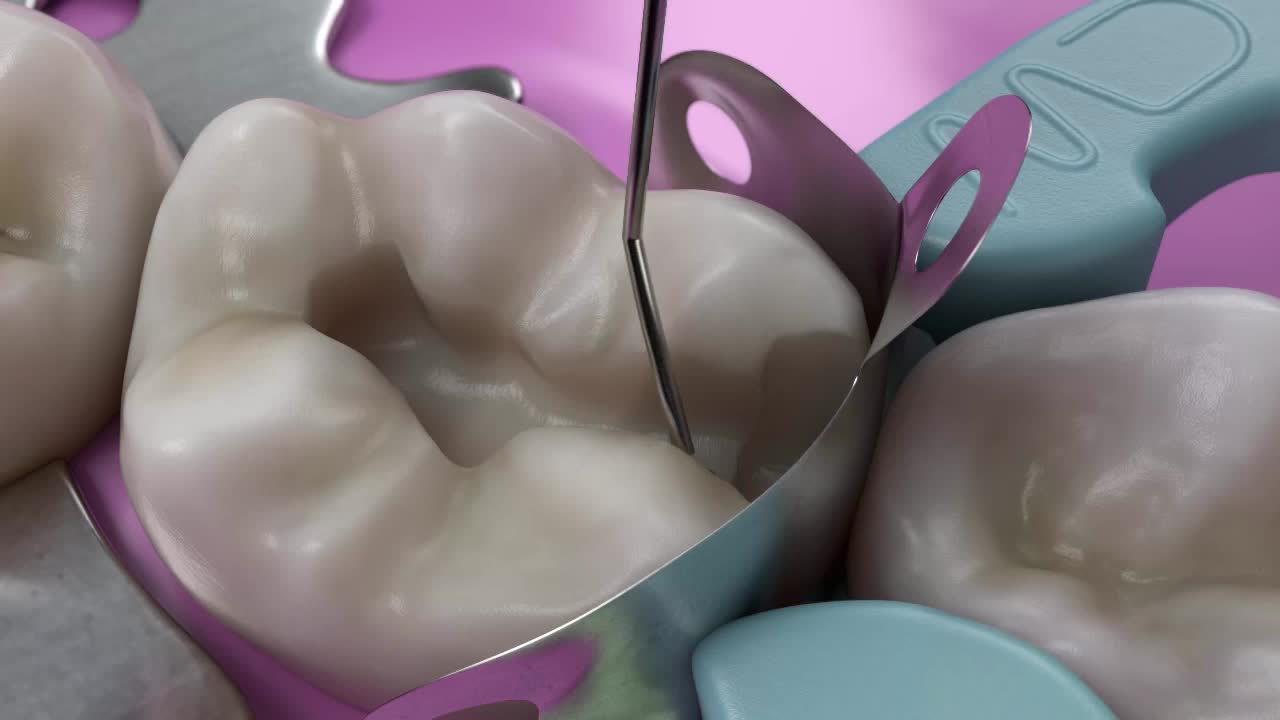牙齿三维机理CG动画